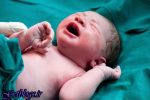 ارتباط بین باکتری موجود در جفت و وضع حمل زودهنگام